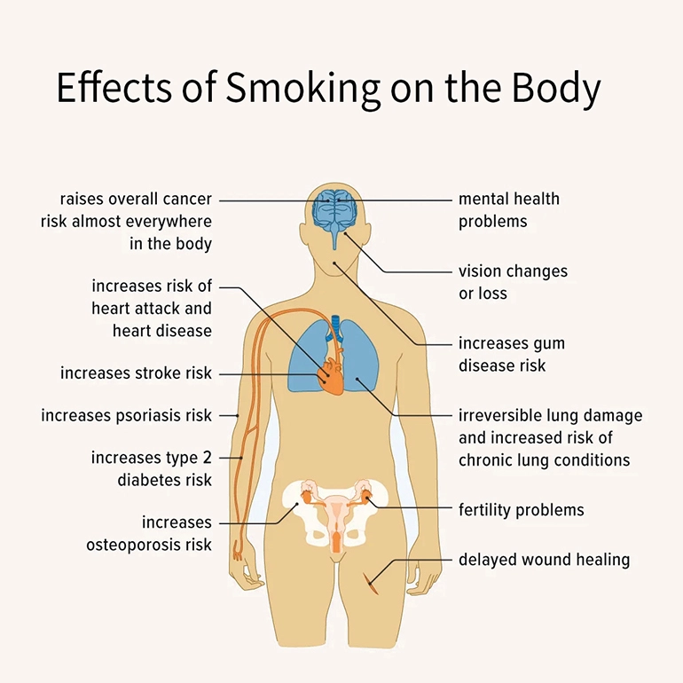 risk of smoking cigarettes