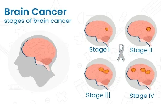 What is a Brain Tumour