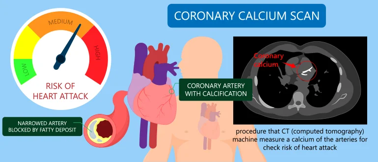 What is Hypercalcemia Coronary Calcium Scan